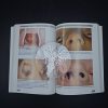 1-587.jpg Color Atlas of ENT Diagnosis Bull, T. R. Paperback Otolaryngology Medical