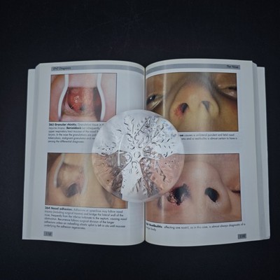 1-587.jpg Color Atlas of ENT Diagnosis Bull, T. R. Paperback Otolaryngology Medical